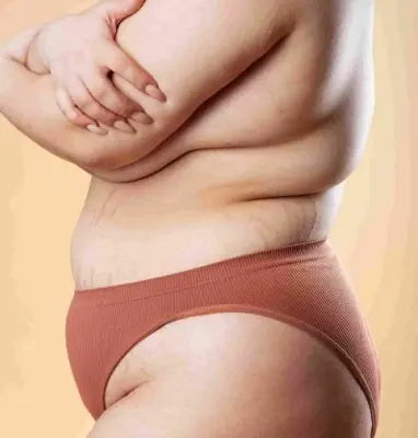 تقويم الاسنان